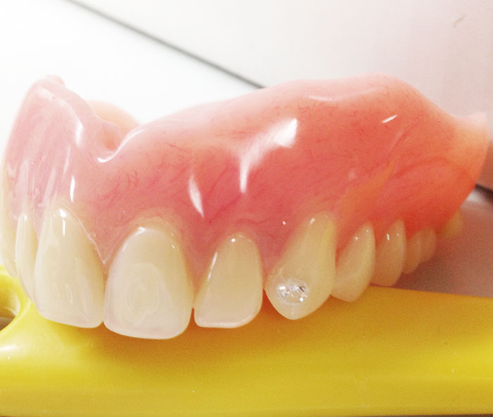 Denture jewelry diamonds diamonte decoration
