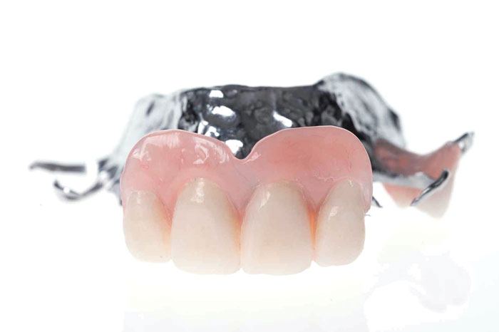 Denture-Premium-chrome-denture-2